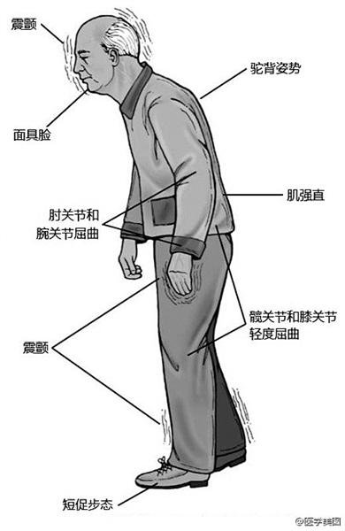 增強(qiáng)脊柱靈活性的簡單鍛煉方法介紹