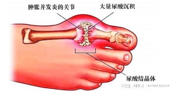 喝水促進(jìn)腎臟功能與新陳代謝平衡，關(guān)鍵所在